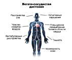 Вегетососудистая дистония (ВСД)