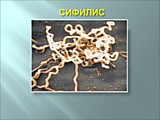 СИФИЛИС